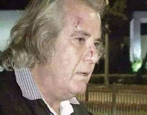 AKP’liler Tarık Akan’ı Darp etti