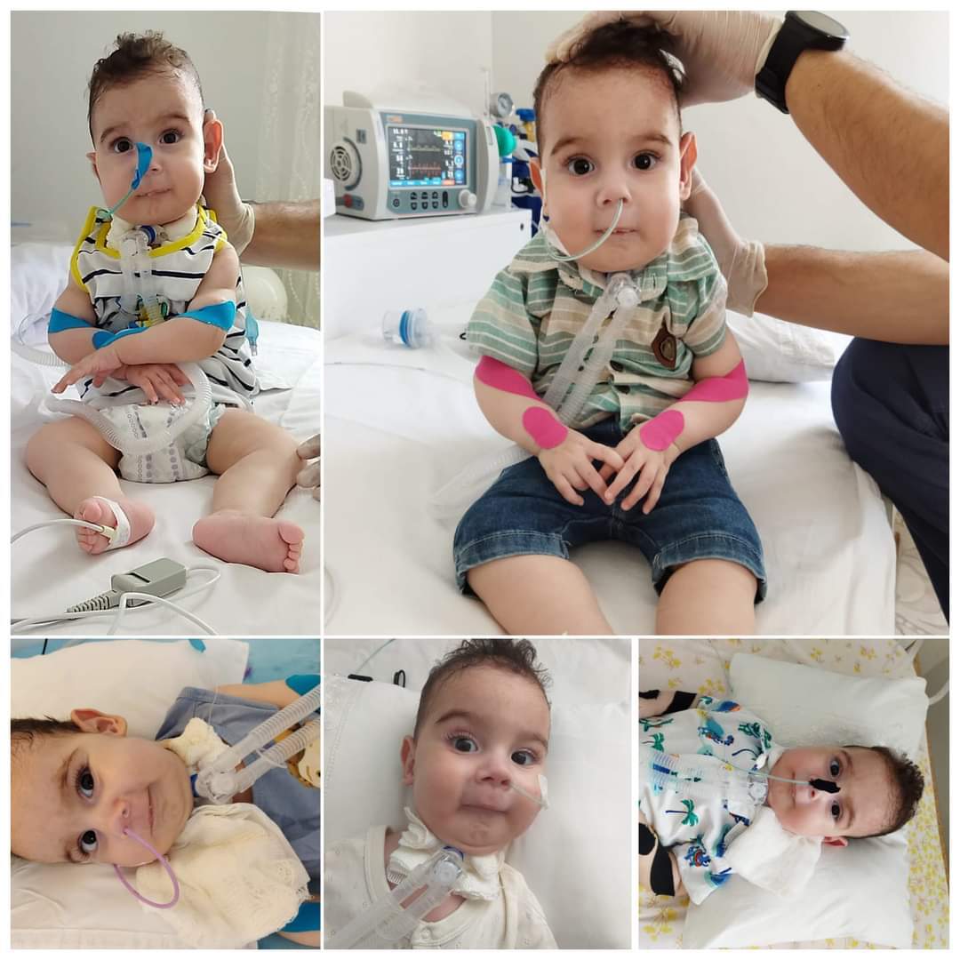 SMA, TUĞKAN BEBEĞİ DE ARAMIZDAN ALDI