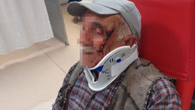 Çorum’da Yaşlı Çifti Yeğenleri Hastanelik Etti!