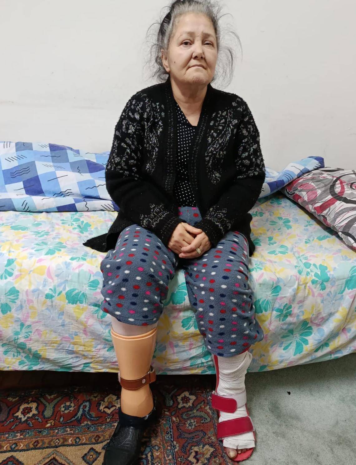Çorum’da Bir Annenin Sessiz Çığlığı: “Ayağımı Kaybettim, Umudumu Kaybetmek İstemiyorum!”