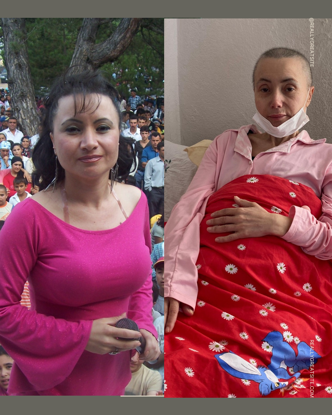 Türküler Öksüz Kalmasın: Sahnelerin Sultanı Yaşam Mücadelesinde!